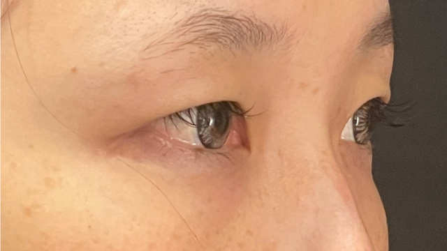 Postoperative Condition Part 1