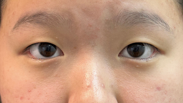 Postoperative Condition Part 1