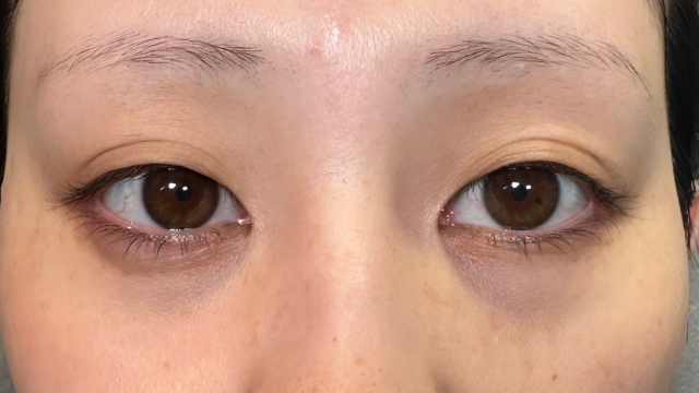 Postoperative Condition Part 1