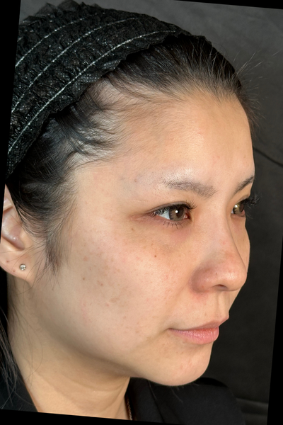 手術前の状態 その1