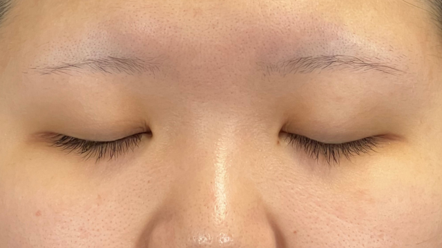 Postoperative Condition Part 1