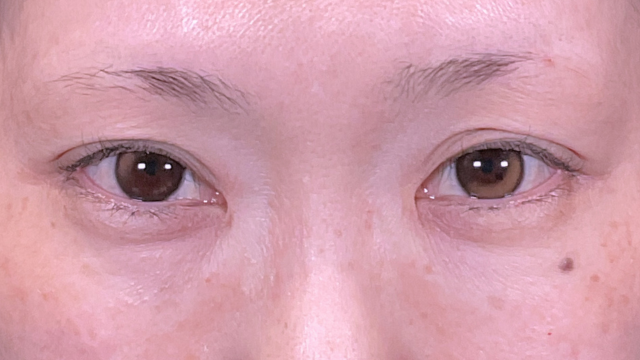 Postoperative Condition Part 1