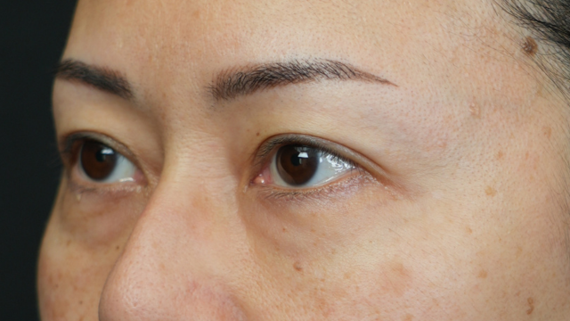 Postoperative Condition Part 1