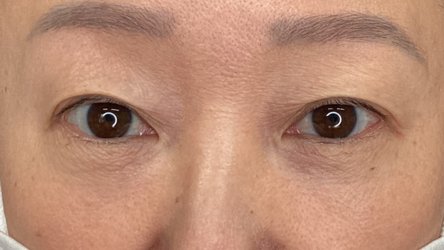 Postoperative Condition Part 1