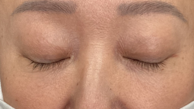 Postoperative Condition Part 1