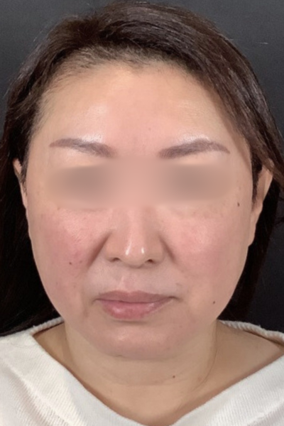 Postoperative Condition Part 1