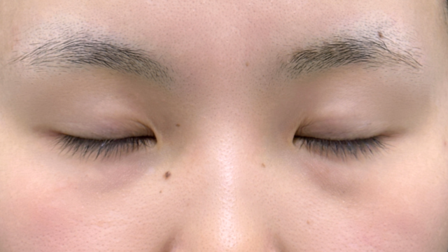 Postoperative Condition Part 1