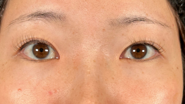 Postoperative Condition Part 1