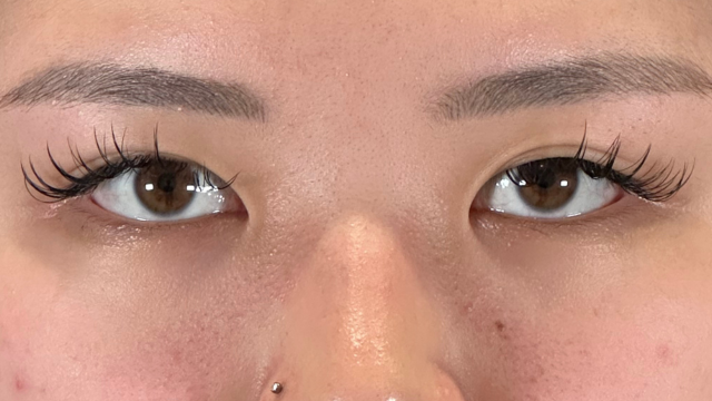 Postoperative Condition Part 1