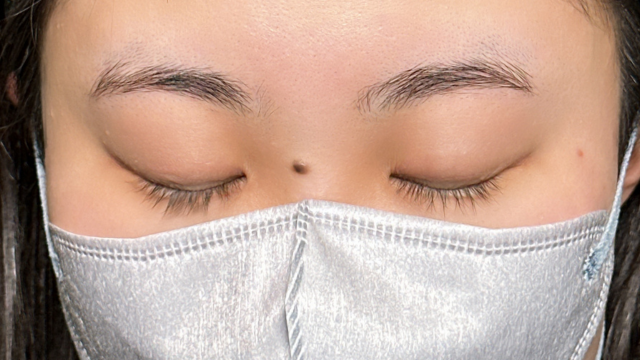 手术前的状态 其一