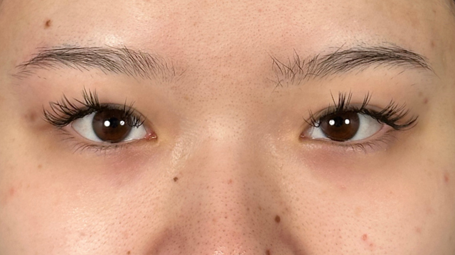 Postoperative Condition Part 1