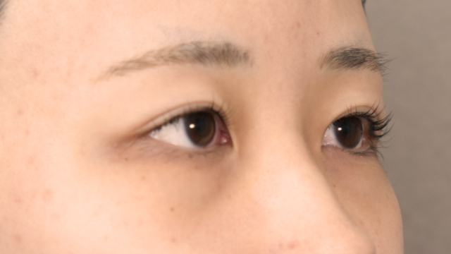 Postoperative Condition Part 1