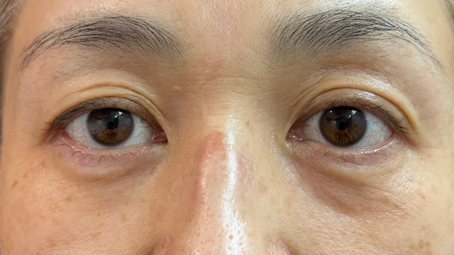 Postoperative Condition Part 1