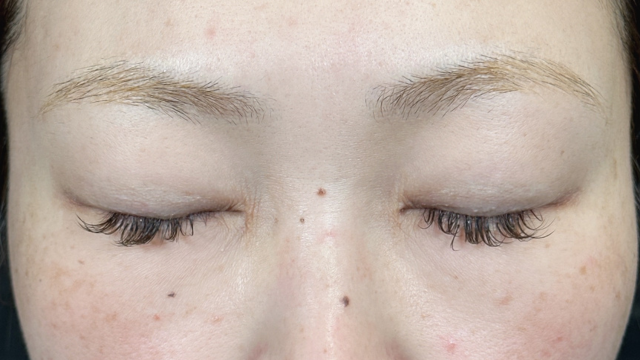 Postoperative Condition Part 1