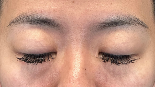 Postoperative Condition Part 1