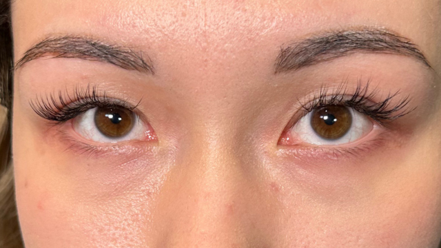 Postoperative Condition Part 1