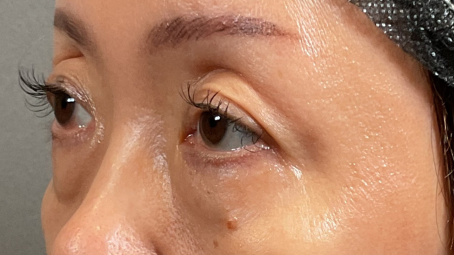 Postoperative Condition Part 1