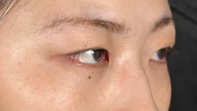 Postoperative Condition Part 1