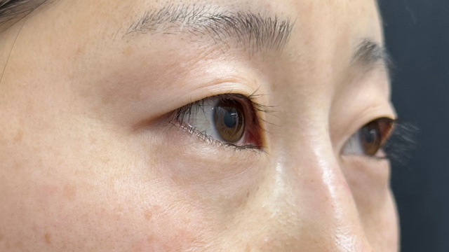 Postoperative Condition Part 1