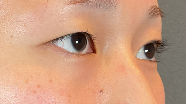 Postoperative Condition Part 1