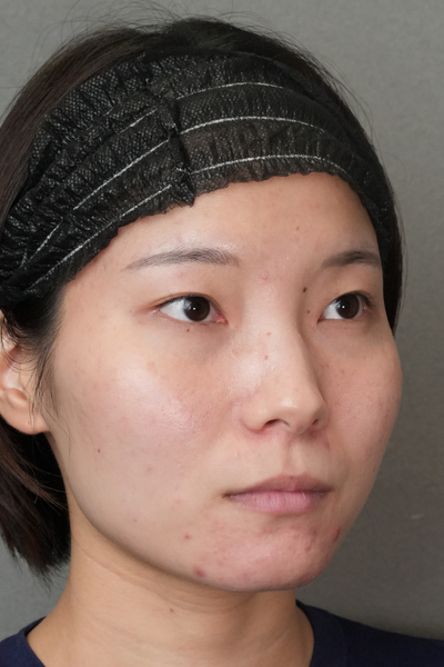 Postoperative Condition Part 1