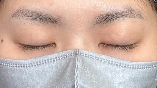 Postoperative Condition Part 1