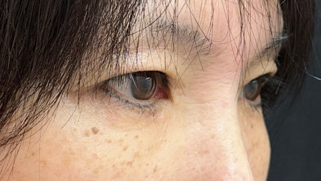 Postoperative Condition Part 1