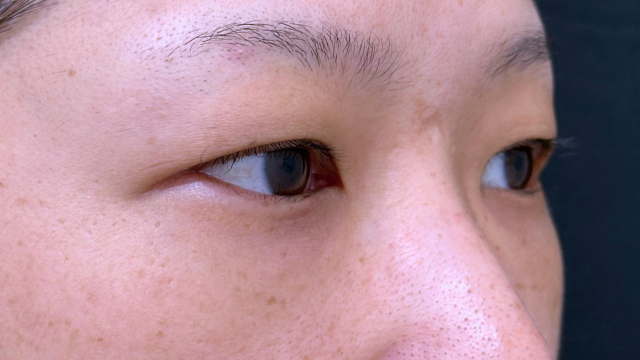 Postoperative Condition Part 1