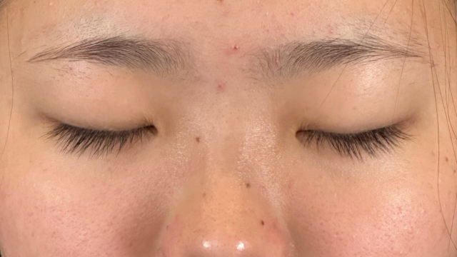 Postoperative Condition Part 1