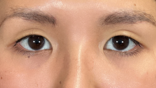 Postoperative Condition Part 1