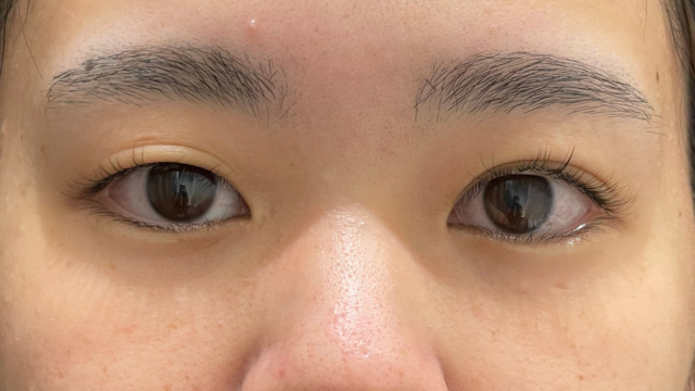 Postoperative Condition Part 1