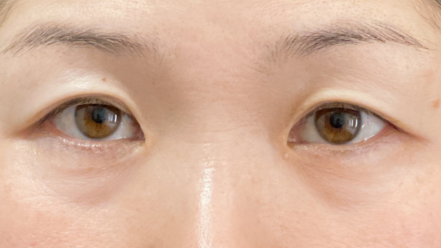 Postoperative Condition Part 1