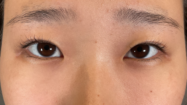 Postoperative Condition Part 1