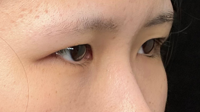 Postoperative Condition Part 1