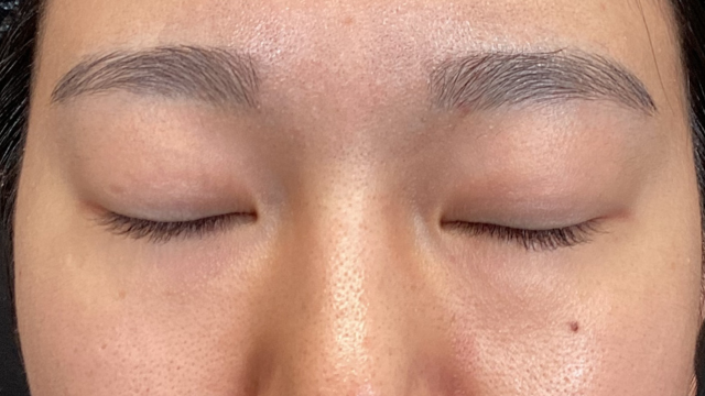 Postoperative Condition Part 1