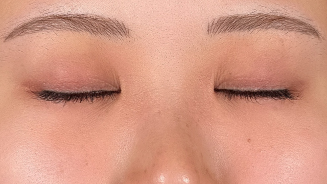 Postoperative Condition Part 1