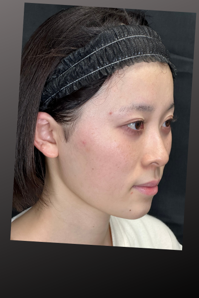 Postoperative Condition Part 1