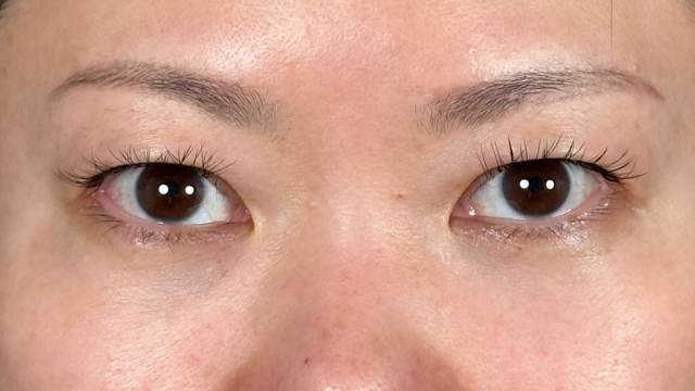 Postoperative Condition Part 1