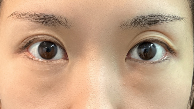 Postoperative Condition Part 1