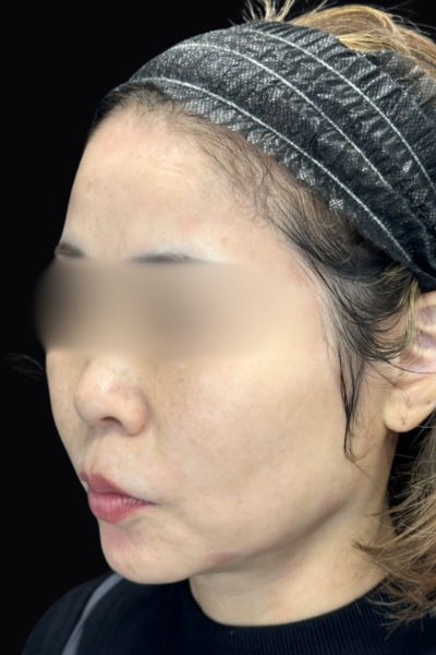 Postoperative Condition Part 1