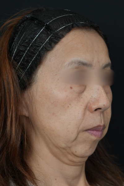 Postoperative Condition Part 1