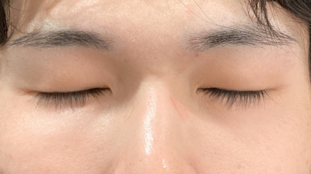 Postoperative Condition Part 1