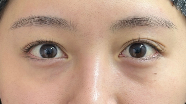 Postoperative Condition Part 1