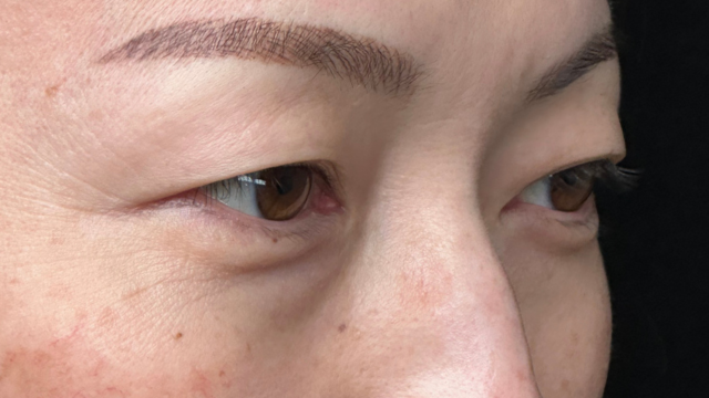 Postoperative Condition Part 1