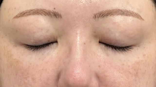 Postoperative Condition Part 1