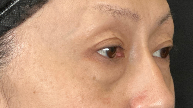 Postoperative Condition Part 1