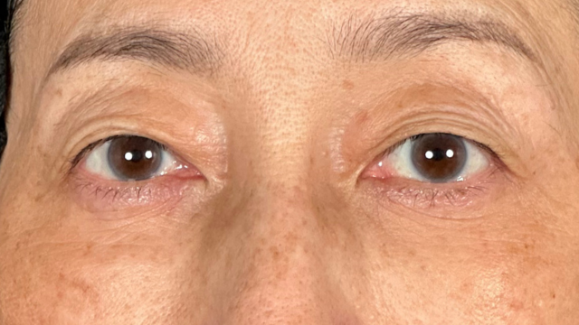 Postoperative Condition Part 1