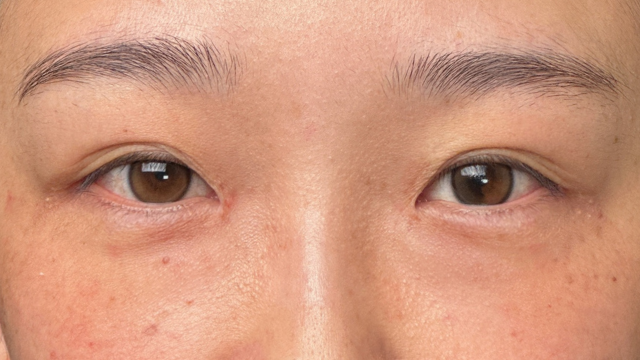 Postoperative Condition Part 1