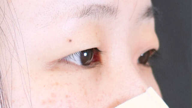 Postoperative Condition Part 1