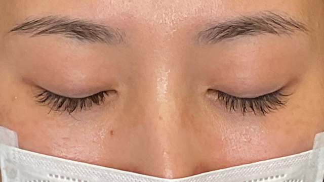 Postoperative Condition Part 1